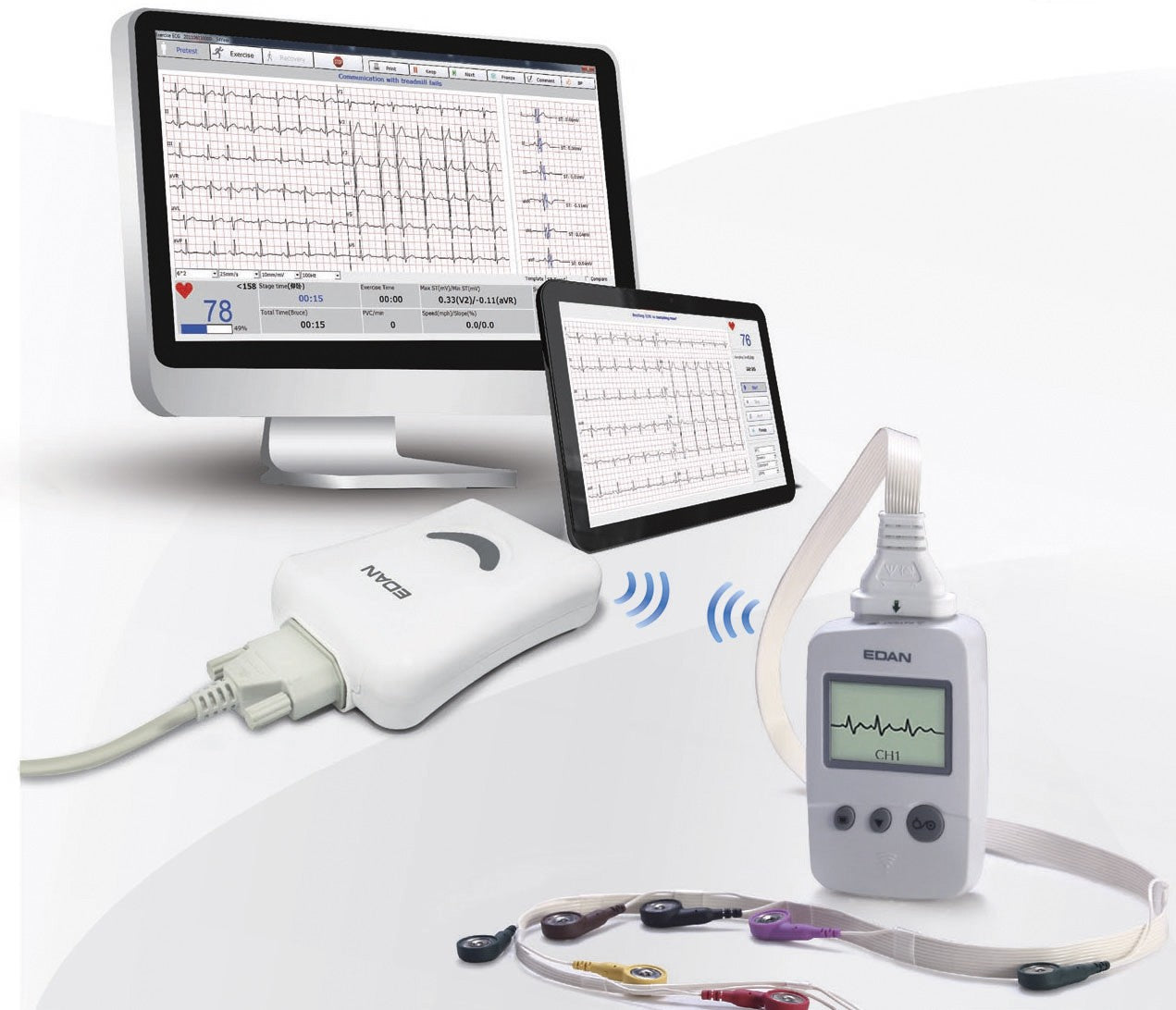 Électrocardiographe Numerique Bluetooth PC SE-1010 - EDAN