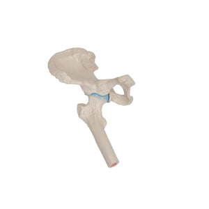 Mini-articulation de la hanche avec coupe transversale, sur socle - Anatomie et pathologie